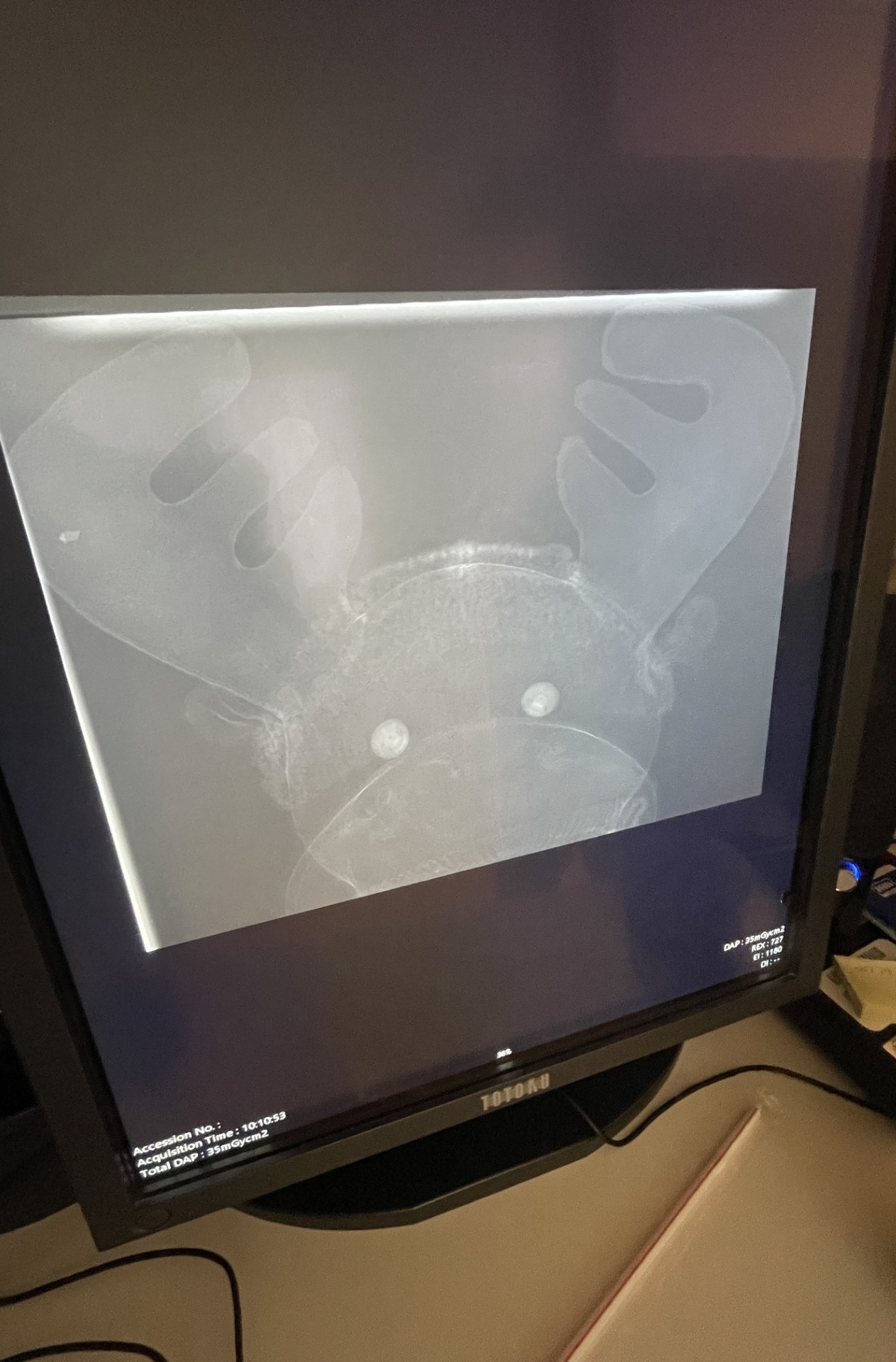 Røntgenbilde av Eik